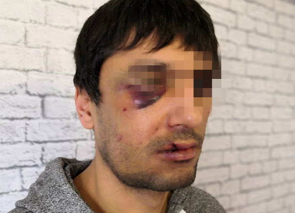 На видеооператора «Блокнот Новороссийск» совершено нападение На видеооператора «Блокнот Новороссийск» совершено нападение