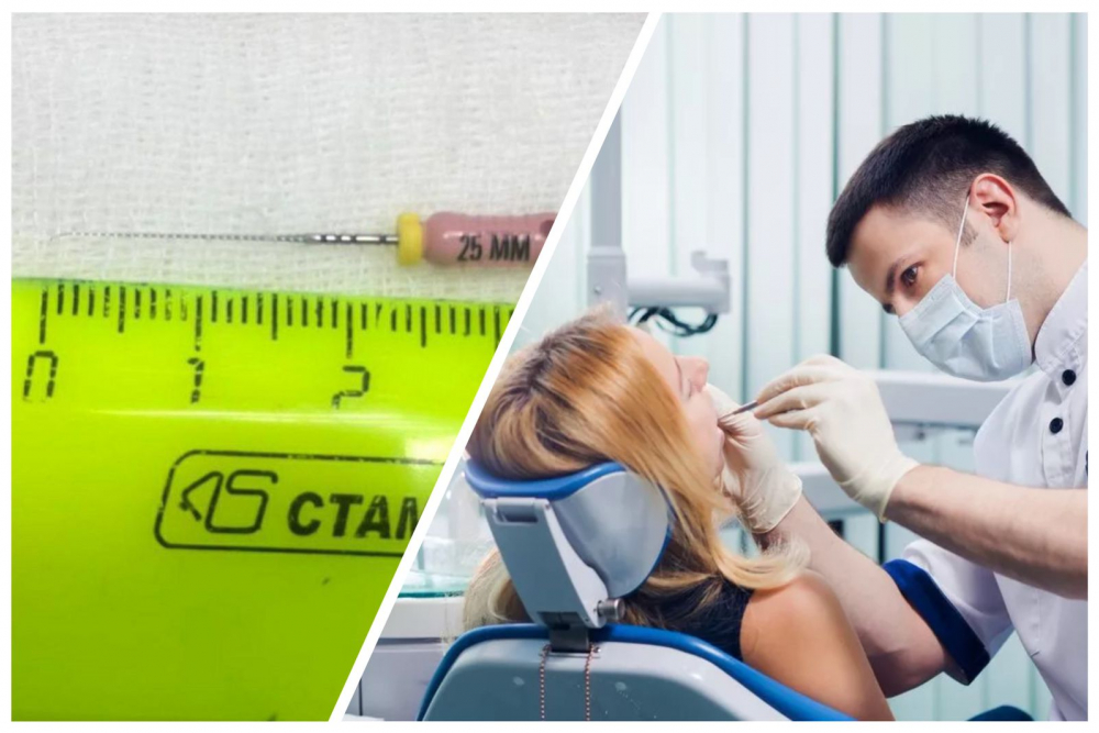 Пациентка проглотила инструмент на приеме у стоматолога в Новороссийске